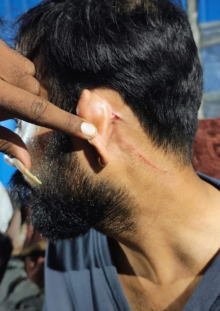 लखनऊ ट्रामा सेंटर में नर्सिंग ऑफिसर पर जानलेवा हमला, मेडिकल स्टूडेंट्स के खिलाफ गंभीर आरोप