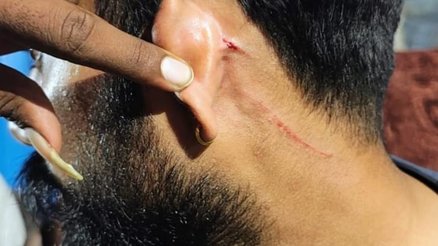 लखनऊ ट्रामा सेंटर में नर्सिंग ऑफिसर पर जानलेवा हमला, मेडिकल स्टूडेंट्स के खिलाफ गंभीर आरोप