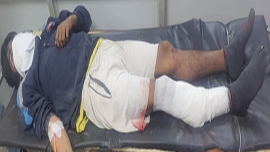 दिल्ली: पुलिस और बदमाश के बीच मुठभेड़, जवाब कार्रवाई के बाद गिरफ्तार